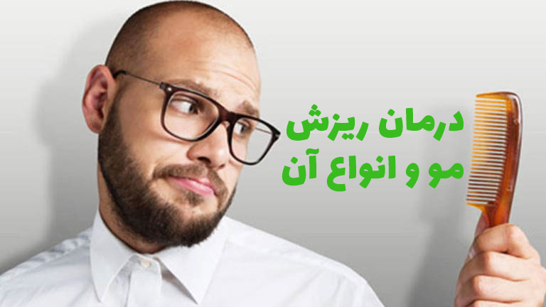 درمان ریزش مو و انواع آن