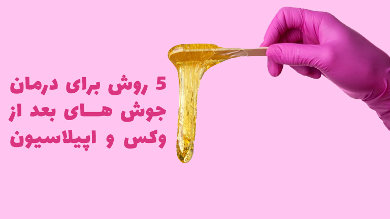 ۵ روش برای درمان جوش های بعد از وکس و اپیلاسیون
